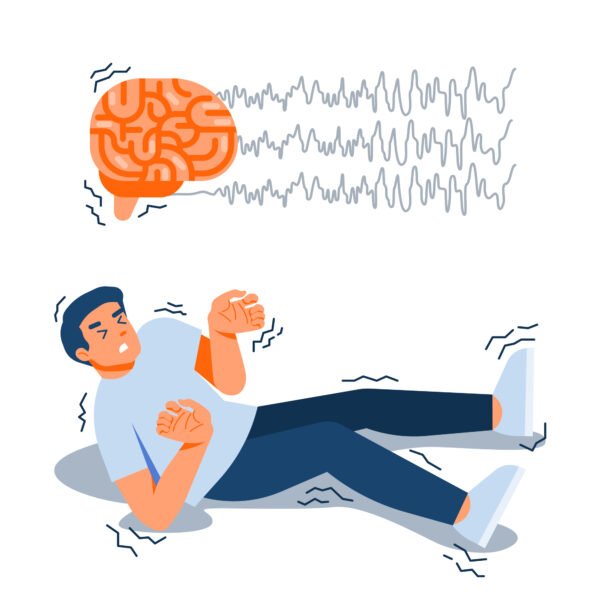 CBD for Epilepsy